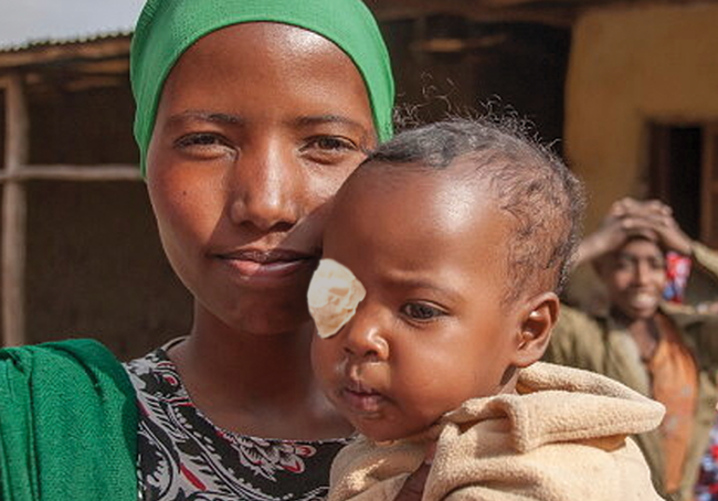 Baby-with-Bandage_Blog